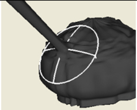 Interpolation