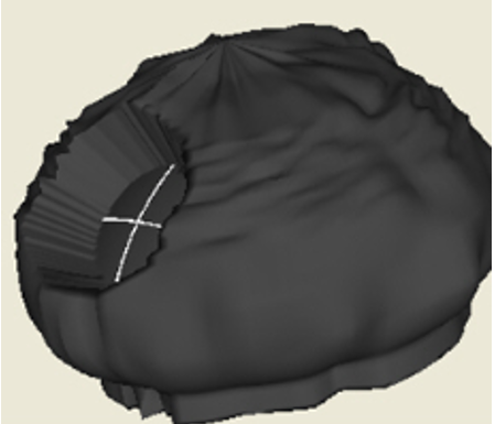 Interpolation