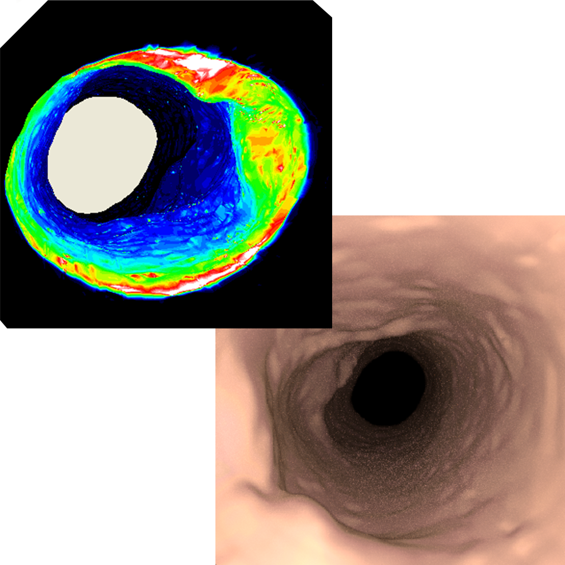 cover_picture_endoscope_camera.png